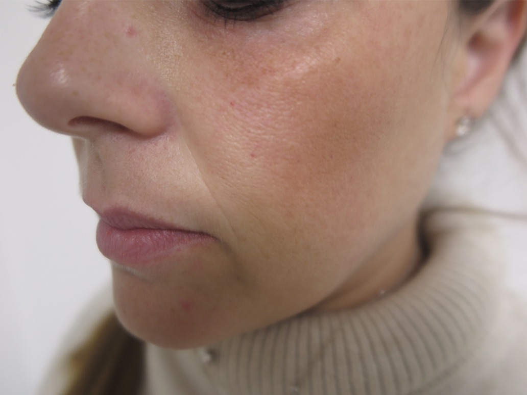 מריונטות לפני